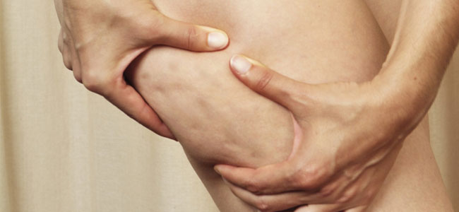 ¿Cómo reducir la celulitis?… Sigue estos pasos