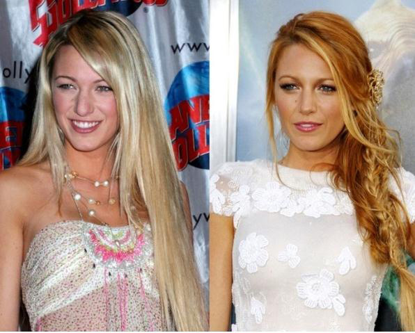 El antes y después de la bella Blake Lively (Foto+nariz y lolas nuevas)