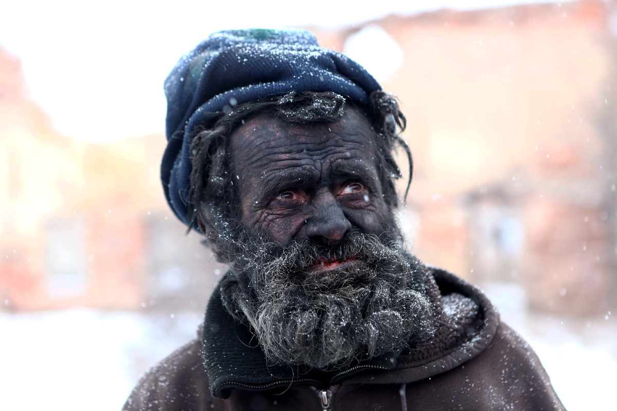 Na´guará… este señor es el hombre más sucio de Europa (FOTOS)