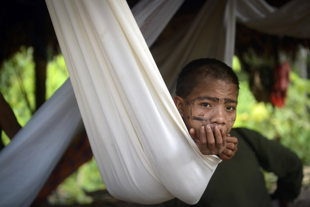 Sarampión ataca a indígenas yanomamis en frontera entre Brasil y Venezuela