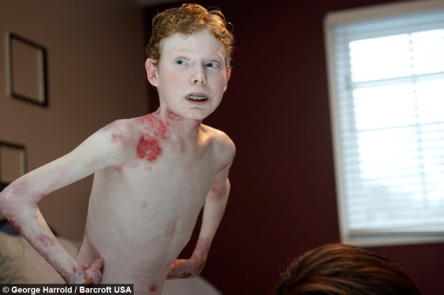 Jonathan Pitre