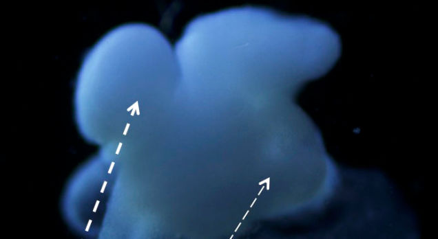 Logran hacer crecer el cerebro en laboratorio de Estados Unidos