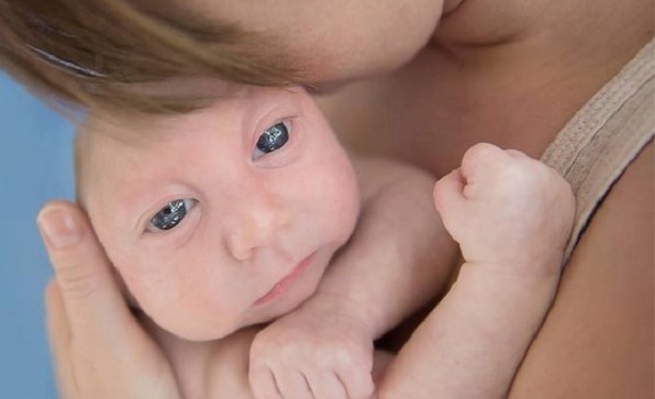 La increíble historia del niño que nació sin la mitad de su cráneo (Fotos)