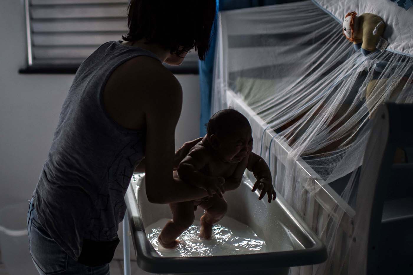 Confirman primer caso de microcefalia ligado al Zika en Florida