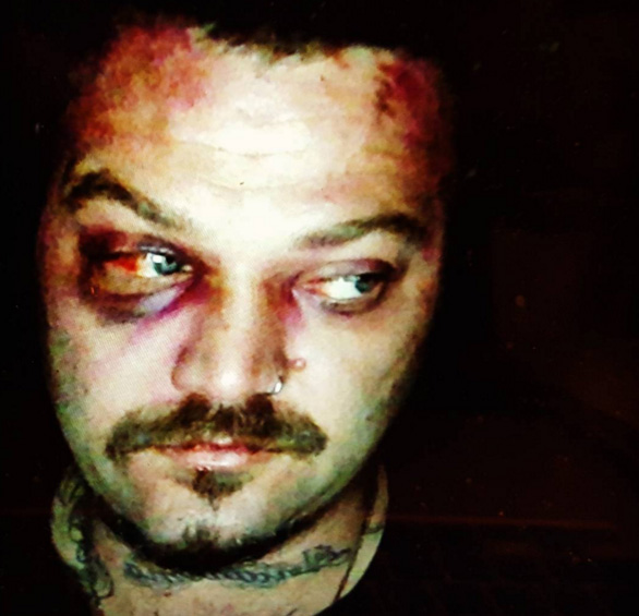 ¿Recuerdas a Bam Margera la estrella de Jackass?… el alcoholismo lo está matando (VIDEOS)