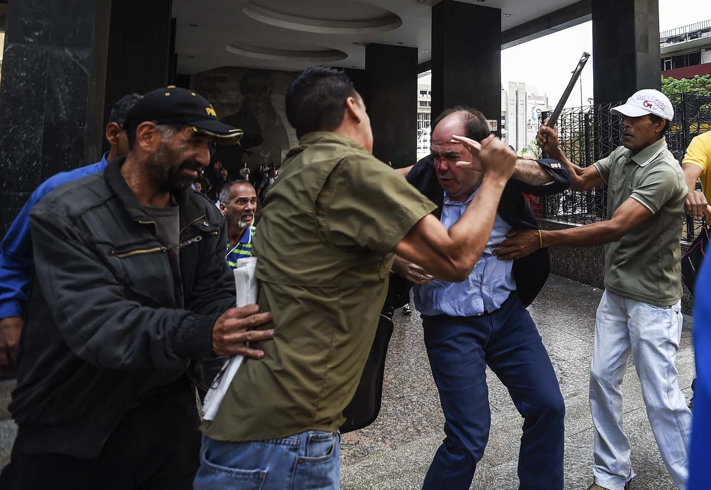 EN FOTOS: Así fue la cobarde agresión a diputados de la Unidad