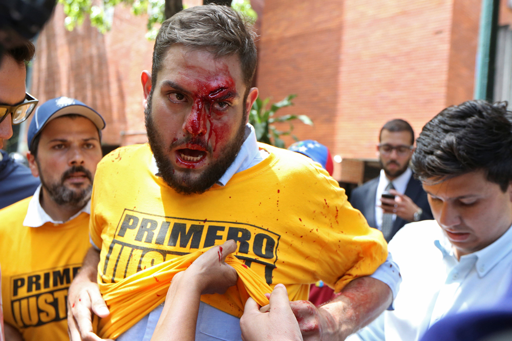 El parte médico de los diputados agredidos este lunes por los colectivos de paz