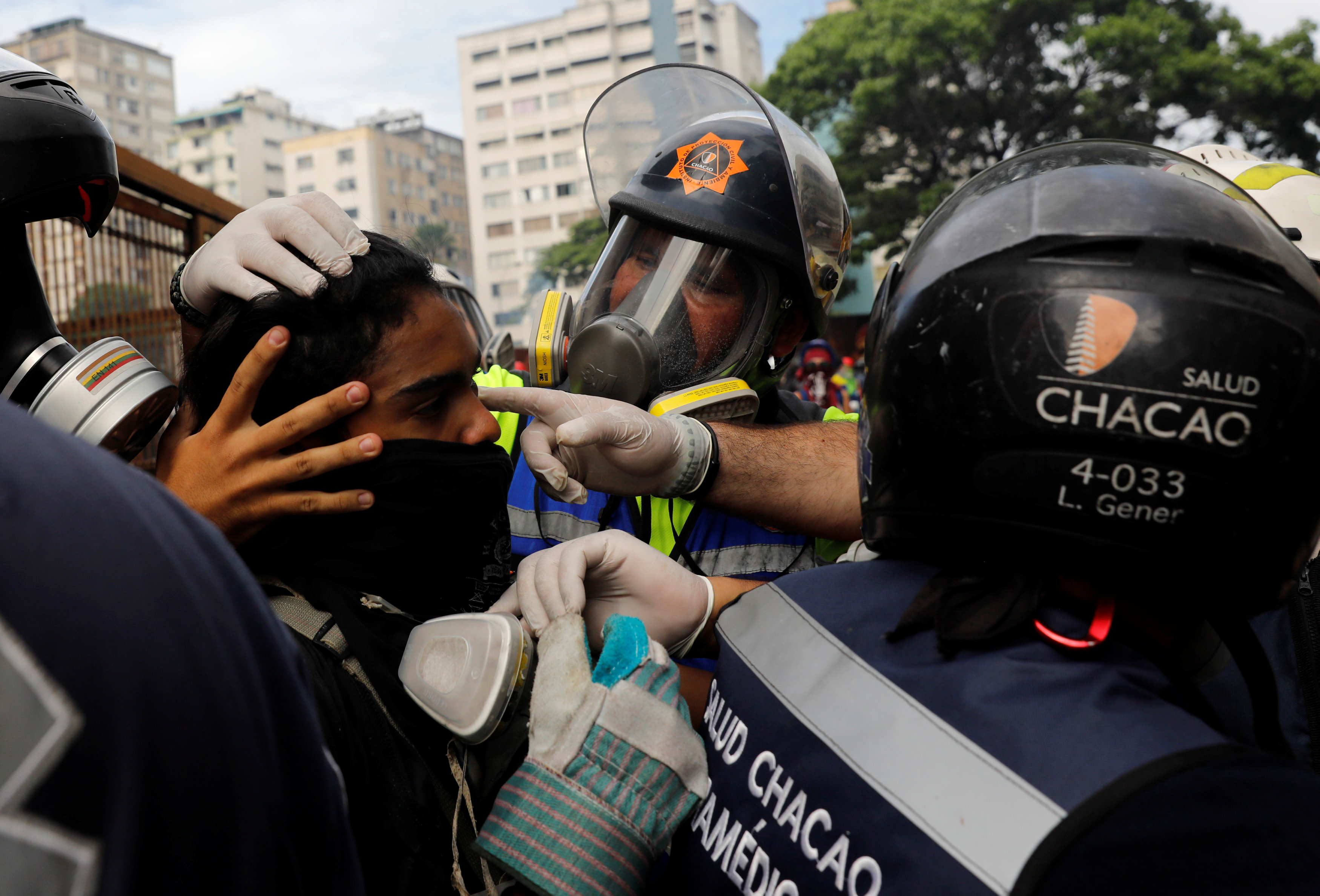 Al menos 164 heridos, entre ellos dos quemados en Salud Chacao (Alcalde)