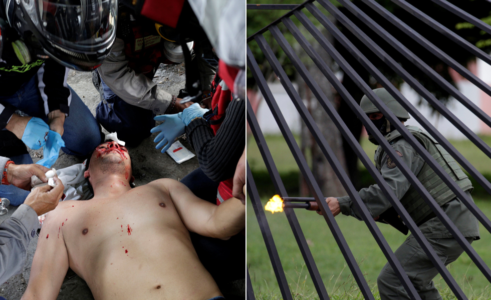 Cerca de 100 heridos por metras, perdigones y lacrimógenas dejó la represión este #31May en Caracas (FOTOS)