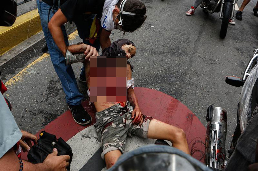 Momento en que trasladan al joven caído en Chacao (Video)