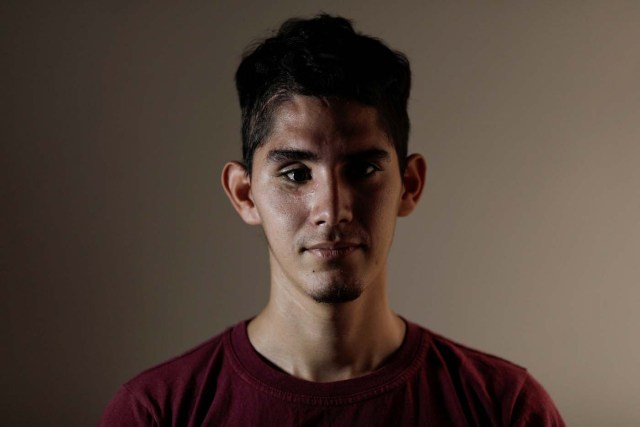David Osorio, 21, an English teacher and a student, who was injured during a protest against Venezuela's President Nicolas Maduro's government, poses for a photograph inside his home in Caracas, Venezuela, August 15, 2017. Osorio said he was struck by a tear gas canister on July 7, 2017, fracturing his skull and leaving him blind in his right eye. He uses a temporary prosthetic eye while seeking specialist treatment. "I have been protesting since 2014. During the last few months, I was actively participating in all the marches, because things have gotten worse and I am against the policies of this government." REUTERS/Ueslei Marcelino SEARCH "VENEZUELA INJURIES" FOR THIS STORY. SEARCH "WIDER IMAGE" FOR ALL STORIES.