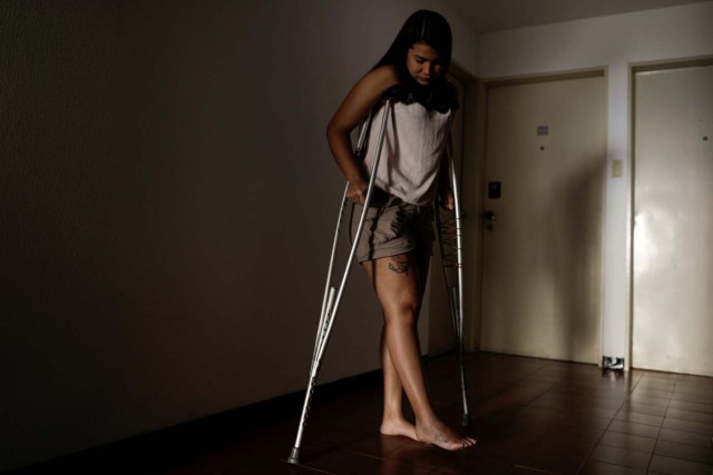 Najhud Najhla Colina, una estudiante de 23 años que resultó herida en una protesta contra el Gobierno de Nicolás Maduro en Venezuela, posa para una fotografía en su casa en Caracas