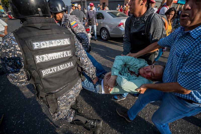 Colectivos hirieron en la cabeza a jefe de seguridad de Henri Falcón en Catia (Fotos)