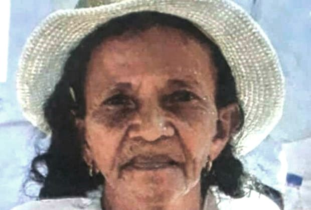 Fallece mujer en Lara luego de ser arrollada por una perrera