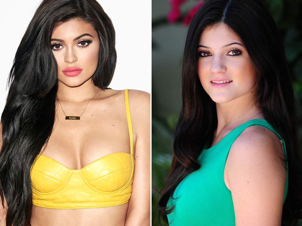 Kylie Jenner revela cuántas cirugías se ha realizado