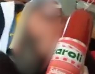 ¡Qué loco! Trabajador de una ambulancia se graba mientras golpea a un paciente con una salchicha (FOTOS)