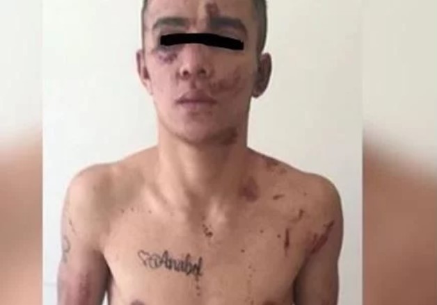 Golpean y echan agua hervida a venezolano en Perú por asesinar a un anciano para robarle el celular