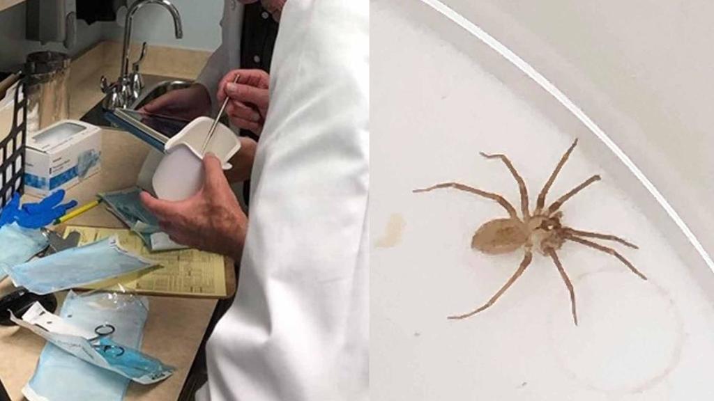 VIRAL: Una araña altamente venenosa resultó ser “el agua” que una mujer creía tener en su oído