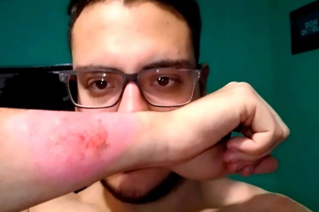 El hombre se quitó el tatuaje en 2017 (Imagen: CEN / @ _ Matycosta)