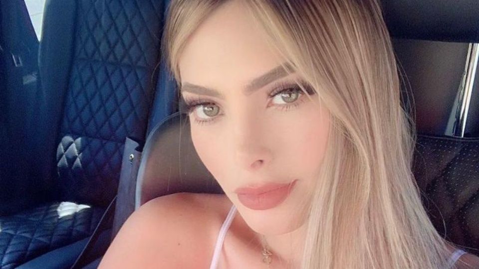 Influencer venezolana muestra heridas de bala tras ataque en México