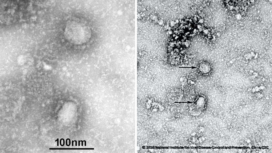 LA FOTO: Publican las primeras imágenes del mortal coronavirus originado en China