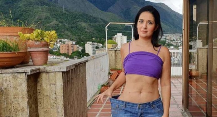 ¡Qué! Lo que Daniela Alvarado ha tenido que hacer para no perder su cirugía bariátrica