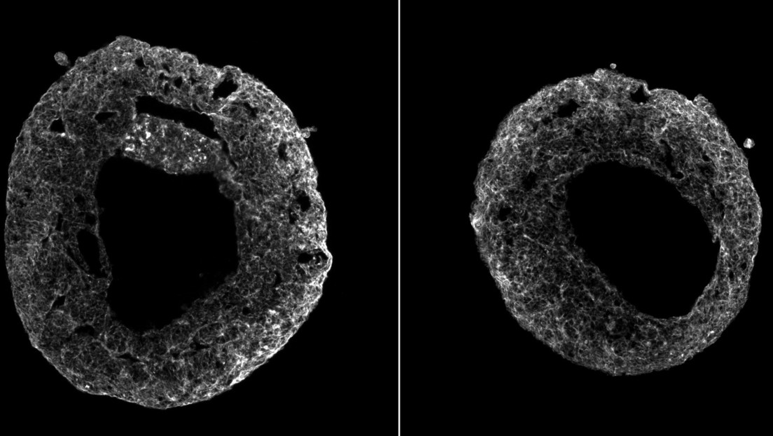 VIDEO: Late el primer modelo de corazón humano cultivado con células madre sin el uso de materiales artificiales