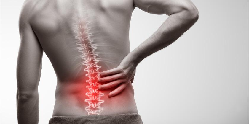 Unos 60 millones de latinoamericanos han sido afectados por dolor lumbar crónico