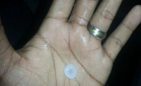 En IMÁGENES: Lluvia acompañada de granizo se hizo presente en Portuguesa