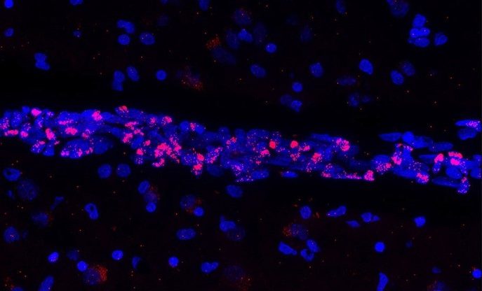 Descubren que el virus causante del Covid-19 provoca la muerte de importantes células del sistema vascular cerebral