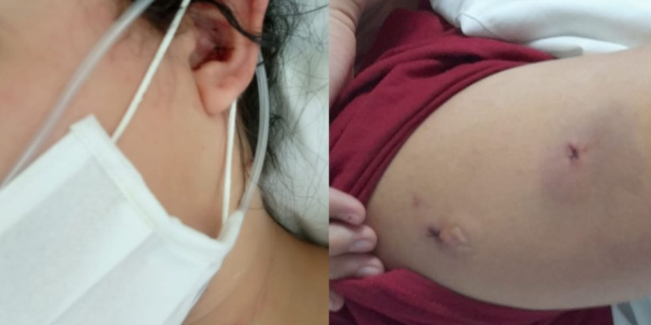 Venezolana fue apuñalada por su expareja con un destornillador en Ecuador