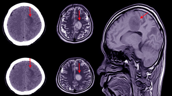 Estuvo a punto de terminar en un asilo psiquiátrico en EEUU, pero su doctora la salvó a último momento