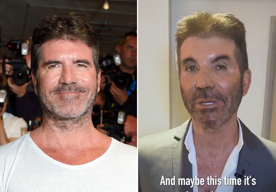 “¿Qué le pasó en la cara?” Simon Cowell vuelve a impactar con su rostro “irreconocible” (FOTOS)