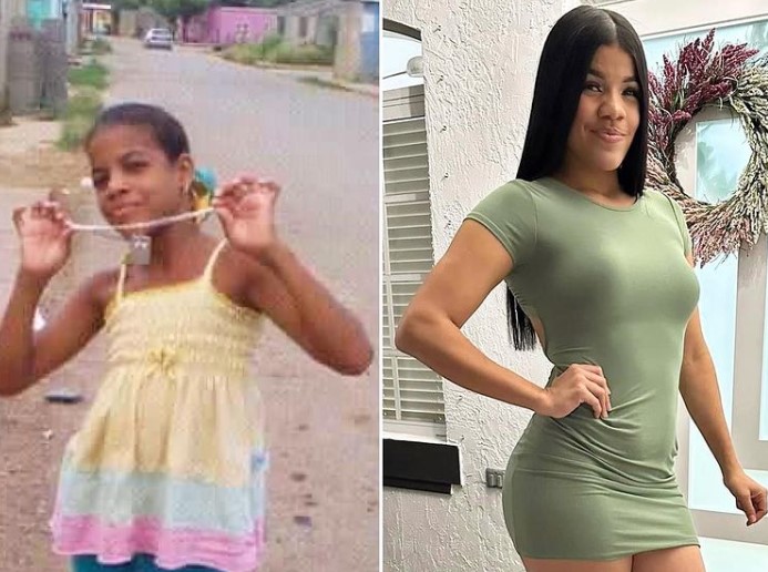 ¡Ufff, mi amor! El antes y después de Yoaibimar La Marginal del que todo el mundo habla en redes (Foto)