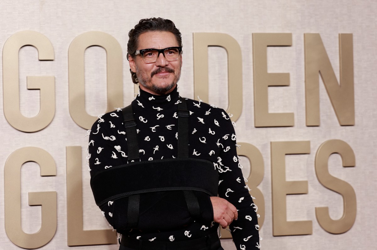 ¿Qué le pasó en el brazo a Pedro Pascal? Así llegó el actor a los Globos de Oro