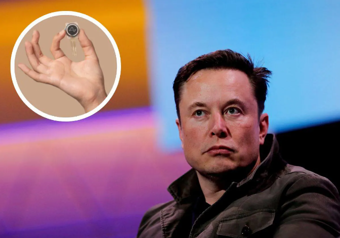 Qué es “Telepathy”, para qué sirve y por qué Elon Musk lo implantó en el cerebro de un humano