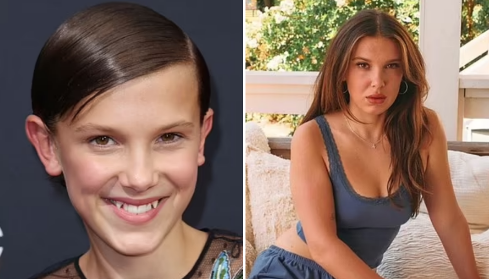 El antes y después de la estrella de “Stranger Things”, criticada por sus procedimientos estéticos que la hacen ver mayor