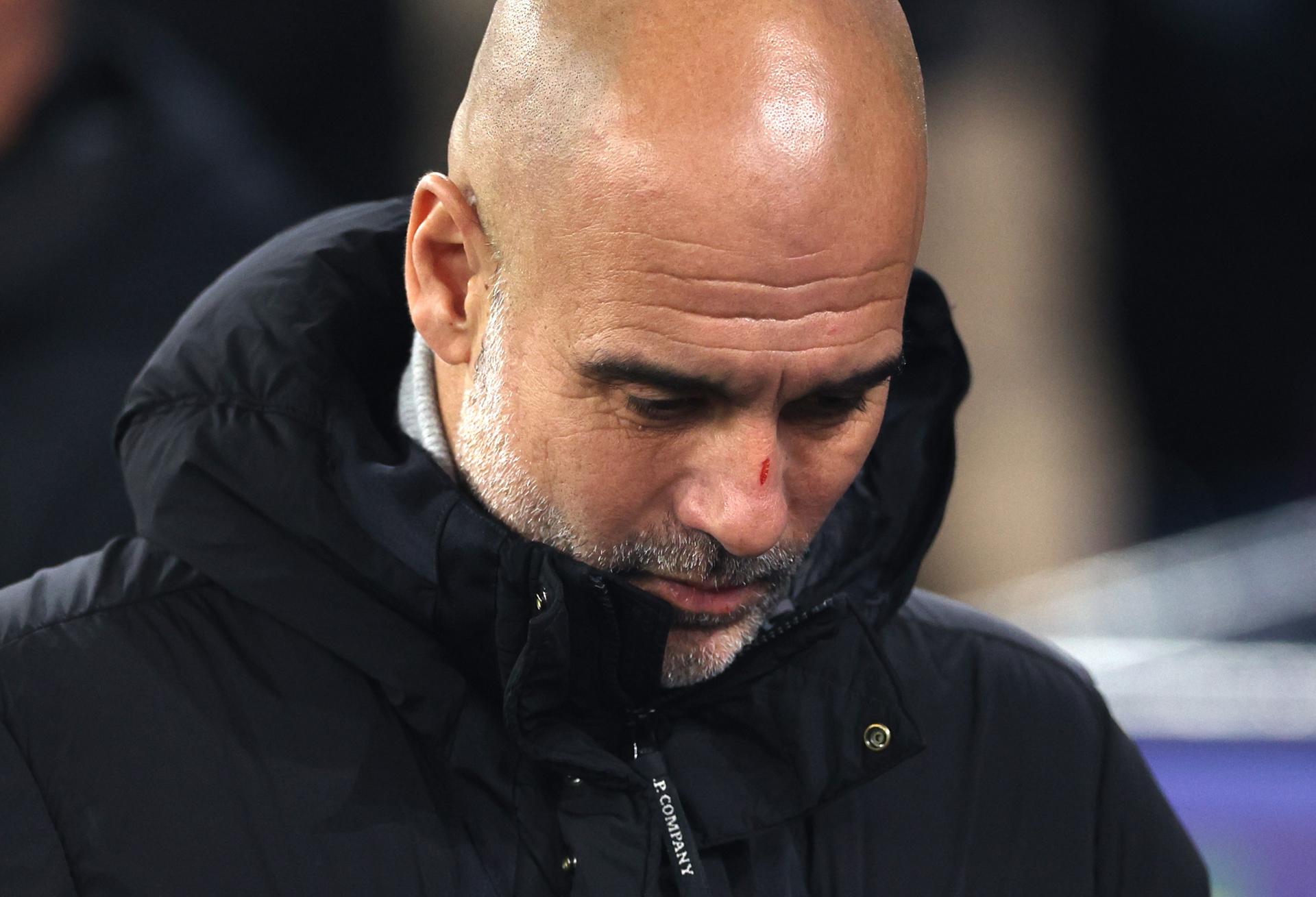 Pep Guardiola se disculpó por su polémica frase después de la derrota del Manchester City